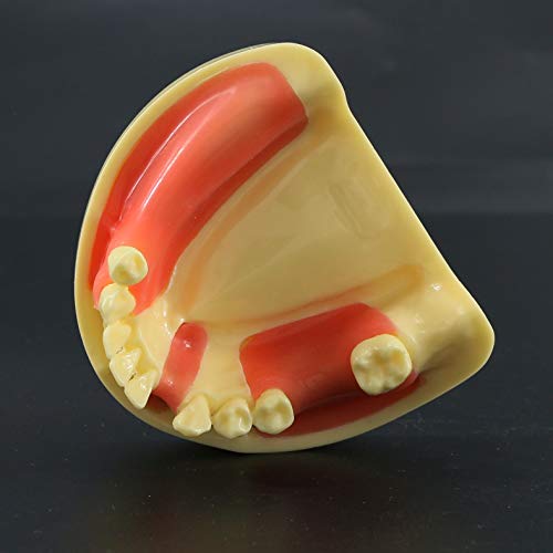 Modelo de dentes de Typodont dental Prática de implante Demonstração de restauração de overdenture para estudo ensinar garingiva removível da mandíbula inferior