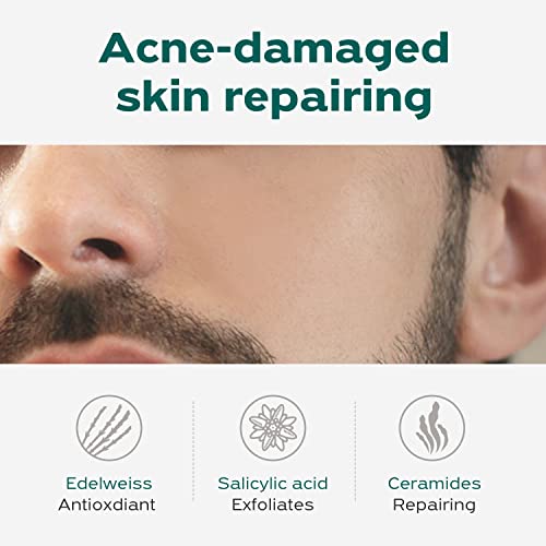 Mantisfy P01s, anti-acne e soro de reparo | Tratamento da acne | Repara a barreira da pele | 1 fl.oz