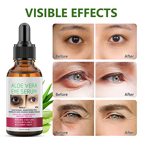 Produtos de tratamento para os olhos do olho, aloe vera sob iluminador ocular, soro anti -envelhecimento para círculo